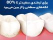 استفاده از مسواک اورال-بی مدل 3D White با برس متوسط اصل